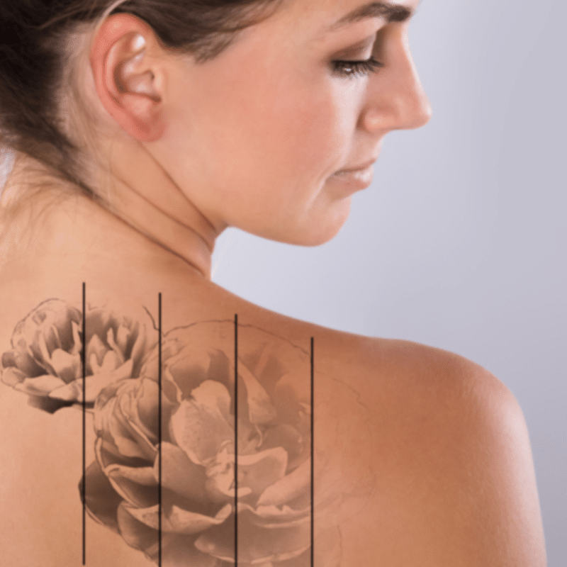micropigmentacion microblading en coruña - eliminacion tatuajes